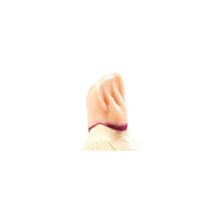 Technowax®-Cervical