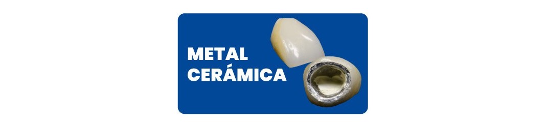 Metal Cerámica para Odontología y Laboratorio Dental